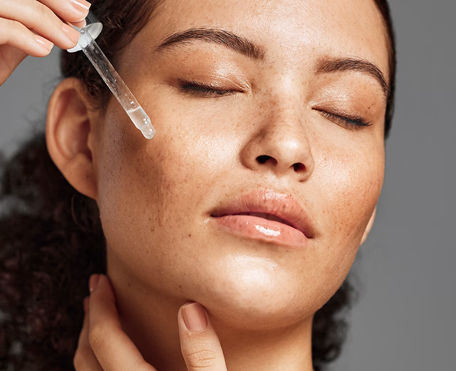 Chemical Peels
