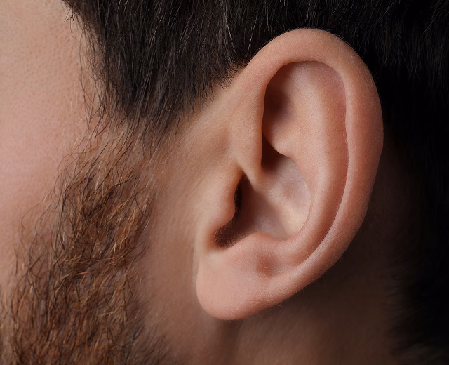 Ear Surgery (Otoplasty)